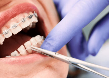Billions of Tenge Stolen Through Fake Dentists