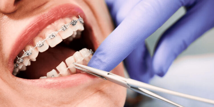 Billions of Tenge Stolen Through Fake Dentists