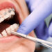 Billions of Tenge Stolen Through Fake Dentists